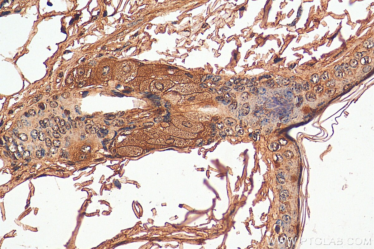 Immunohistochemistry (IHC) staining of mouse skin tissue using C15orf55 Polyclonal antibody (28639-1-AP)