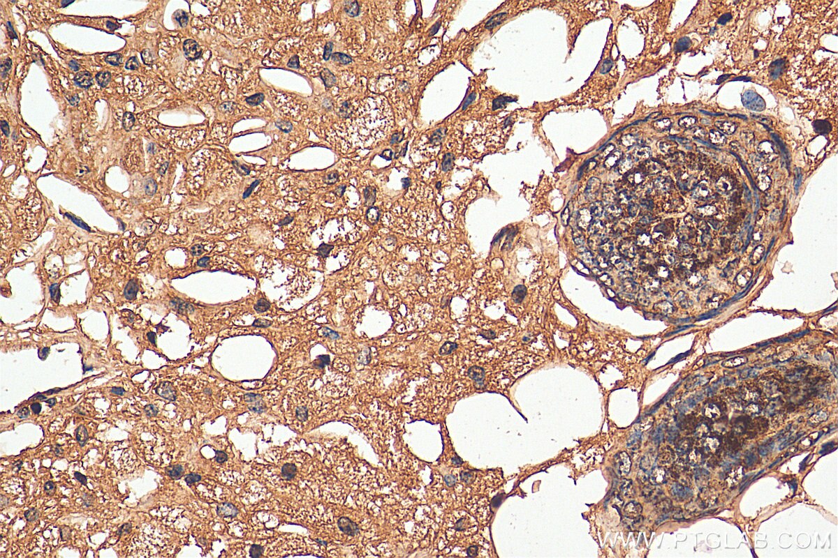 Immunohistochemistry (IHC) staining of mouse skin tissue using C15orf55 Polyclonal antibody (28639-1-AP)