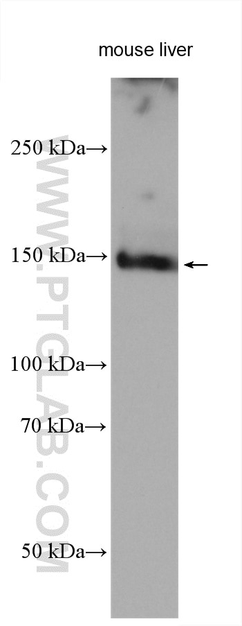 Western Blot (WB) analysis of various lysates using C15orf55 Polyclonal antibody (28639-1-AP)