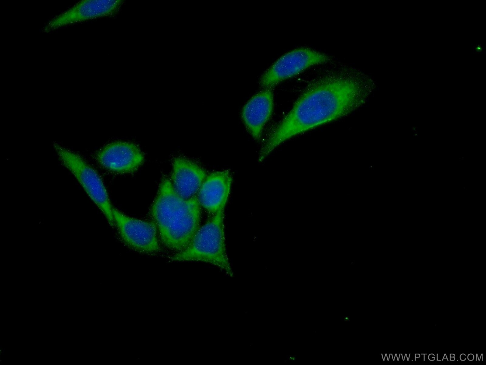 Immunofluorescence (IF) / fluorescent staining of PC-3 cells using C15orf58 Polyclonal antibody (25447-1-AP)