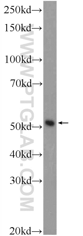 Western Blot (WB) analysis of PC-3 cells using C15orf58 Polyclonal antibody (25447-1-AP)