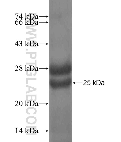 C15orf58 fusion protein Ag20215 SDS-PAGE