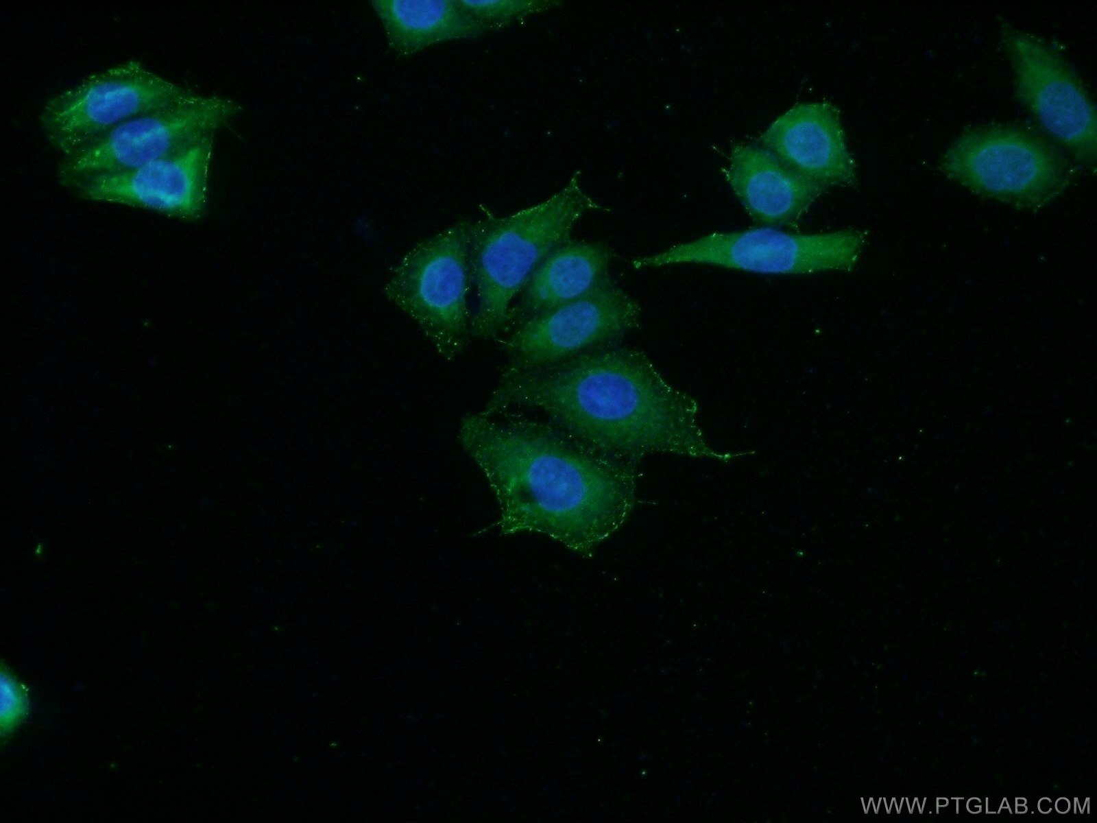 Immunofluorescence (IF) / fluorescent staining of HeLa cells using C16orf13 Polyclonal antibody (20801-1-AP)