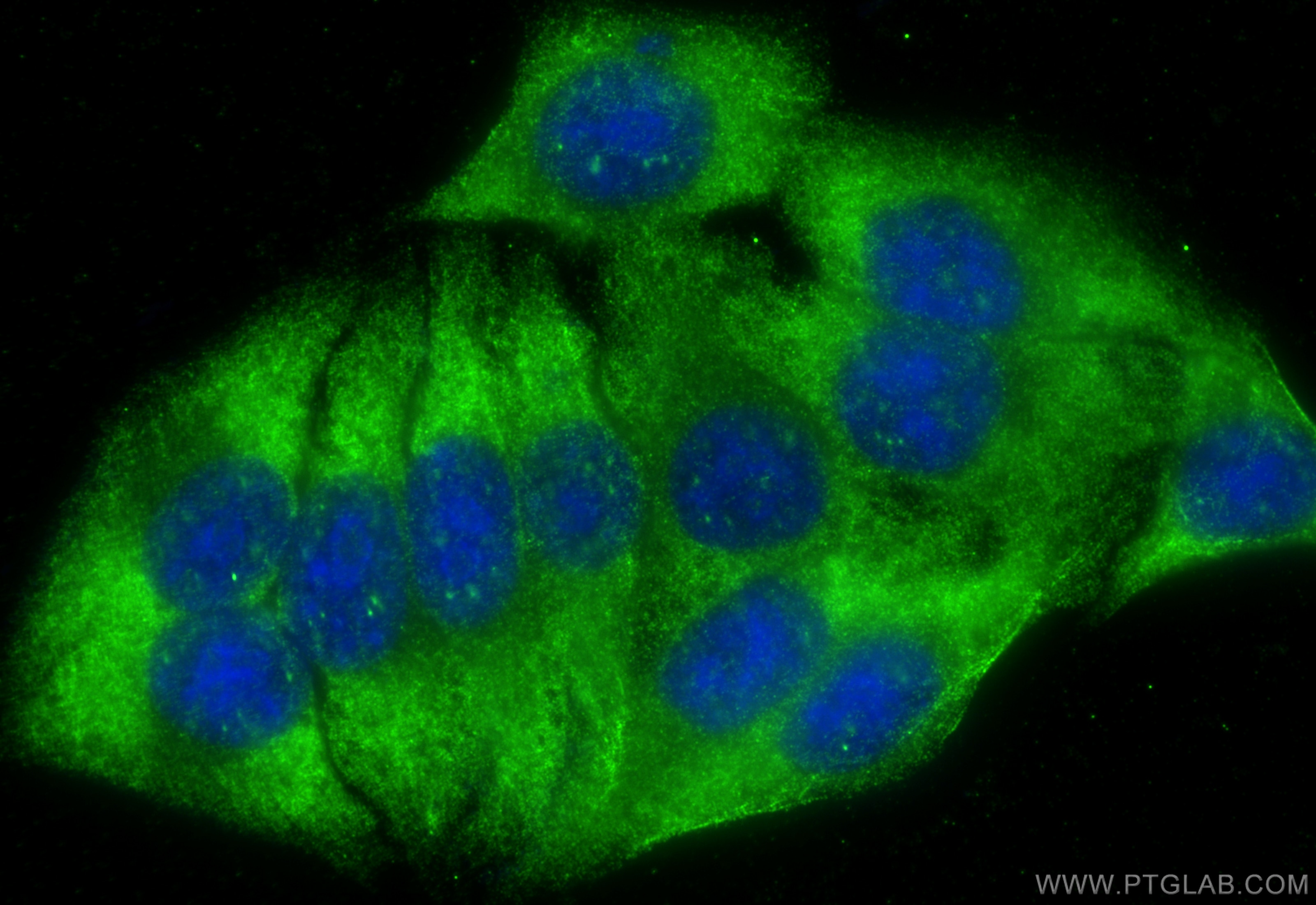 Immunofluorescence (IF) / fluorescent staining of HepG2 cells using C16orf14 Polyclonal antibody (20808-1-AP)