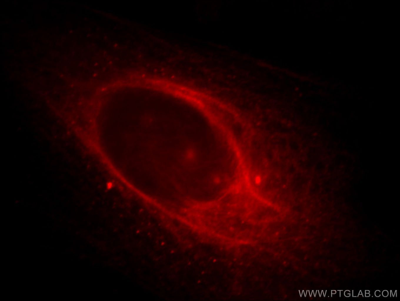 Immunofluorescence (IF) / fluorescent staining of HeLa cells using C16orf14 Polyclonal antibody (20808-1-AP)
