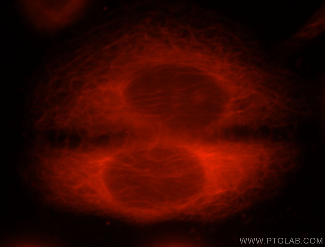 IF Staining of HepG2 using 20808-1-AP