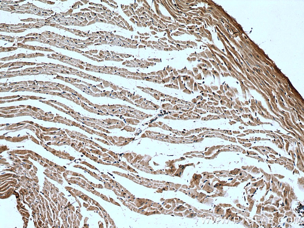 Immunohistochemistry (IHC) staining of mouse heart tissue using C16orf14 Polyclonal antibody (20808-1-AP)