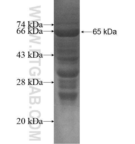 C16orf48 fusion protein Ag14613 SDS-PAGE C16orf48 fusion protein Ag14613 SDS-PAGE
