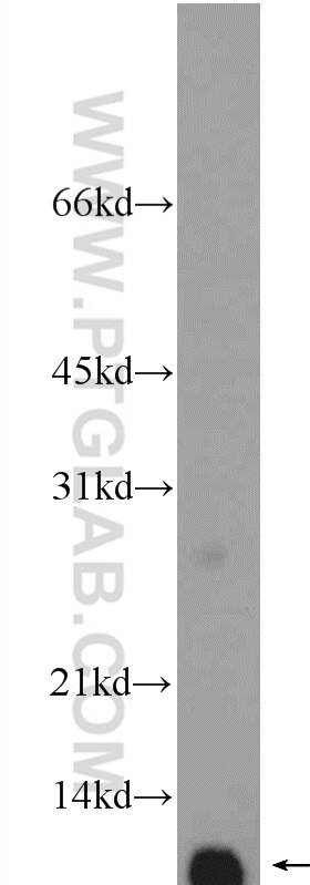 Western Blot (WB) analysis of human kidney tissue using C16orf61 Polyclonal antibody (26086-1-AP)