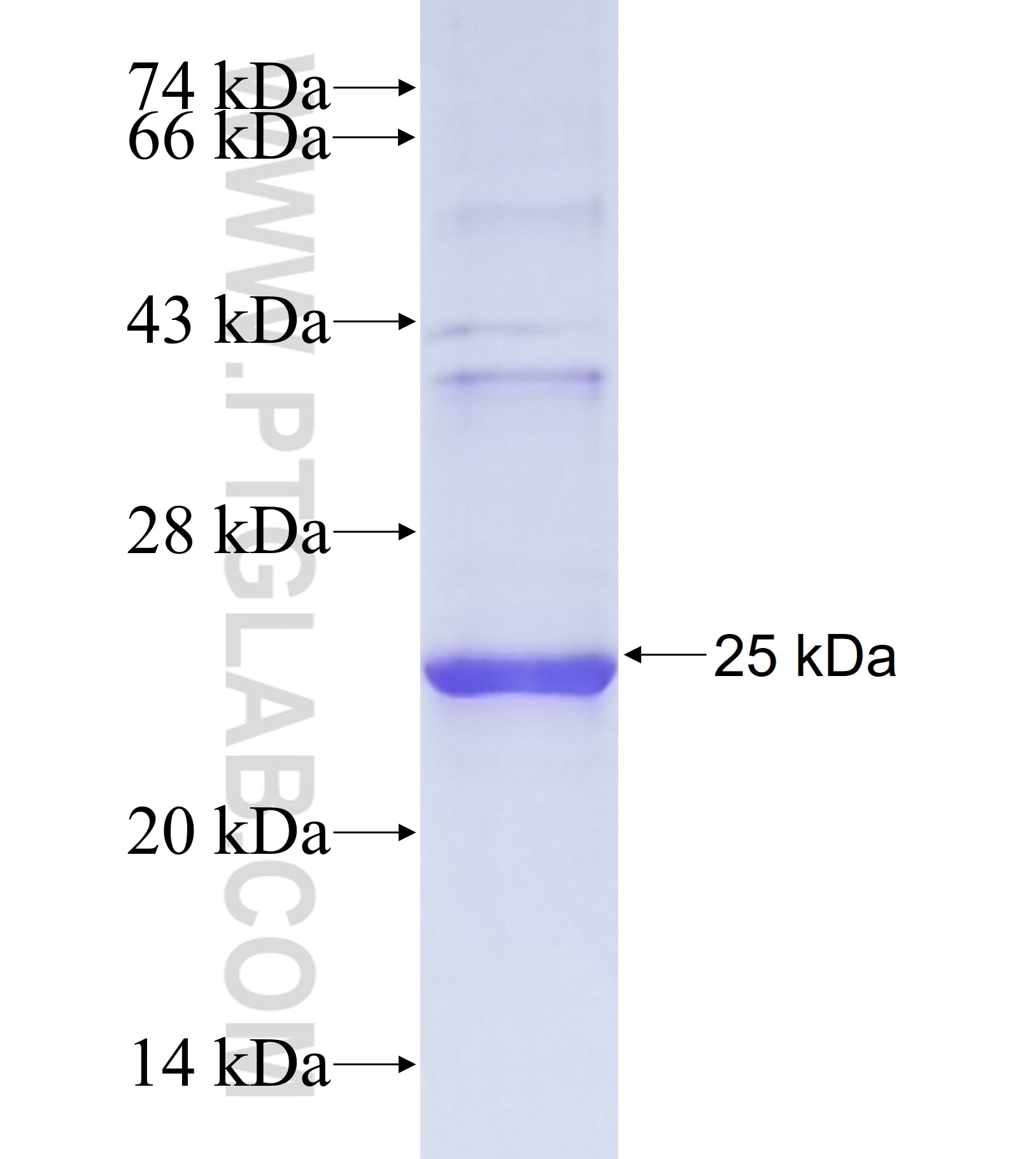 C16orf7 fusion protein Ag41173 SDS-PAGE C16orf7 fusion protein Ag41173 SDS-PAGE