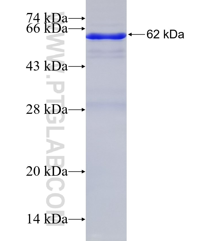 C16orf70 fusion protein Ag14576 SDS-PAGE
