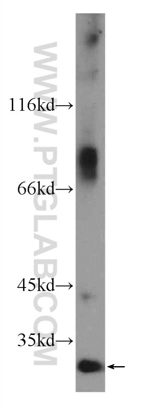 Western Blot (WB) analysis of HeLa cells using C16orf72 Polyclonal antibody (24522-1-AP)