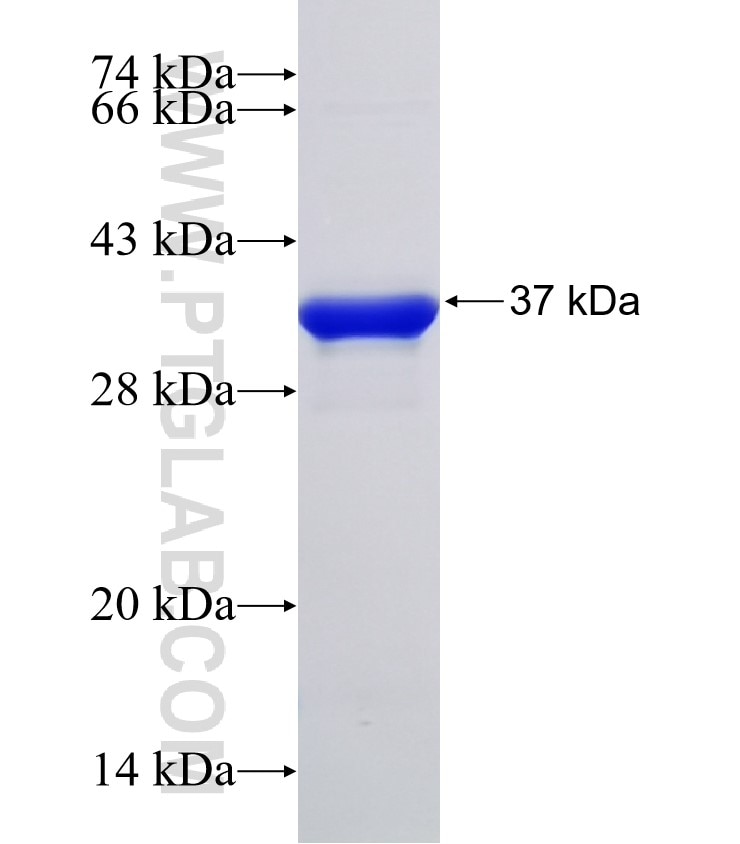 C16orf74 fusion protein Ag32878 SDS-PAGE C16orf74 fusion protein Ag32878 SDS-PAGE