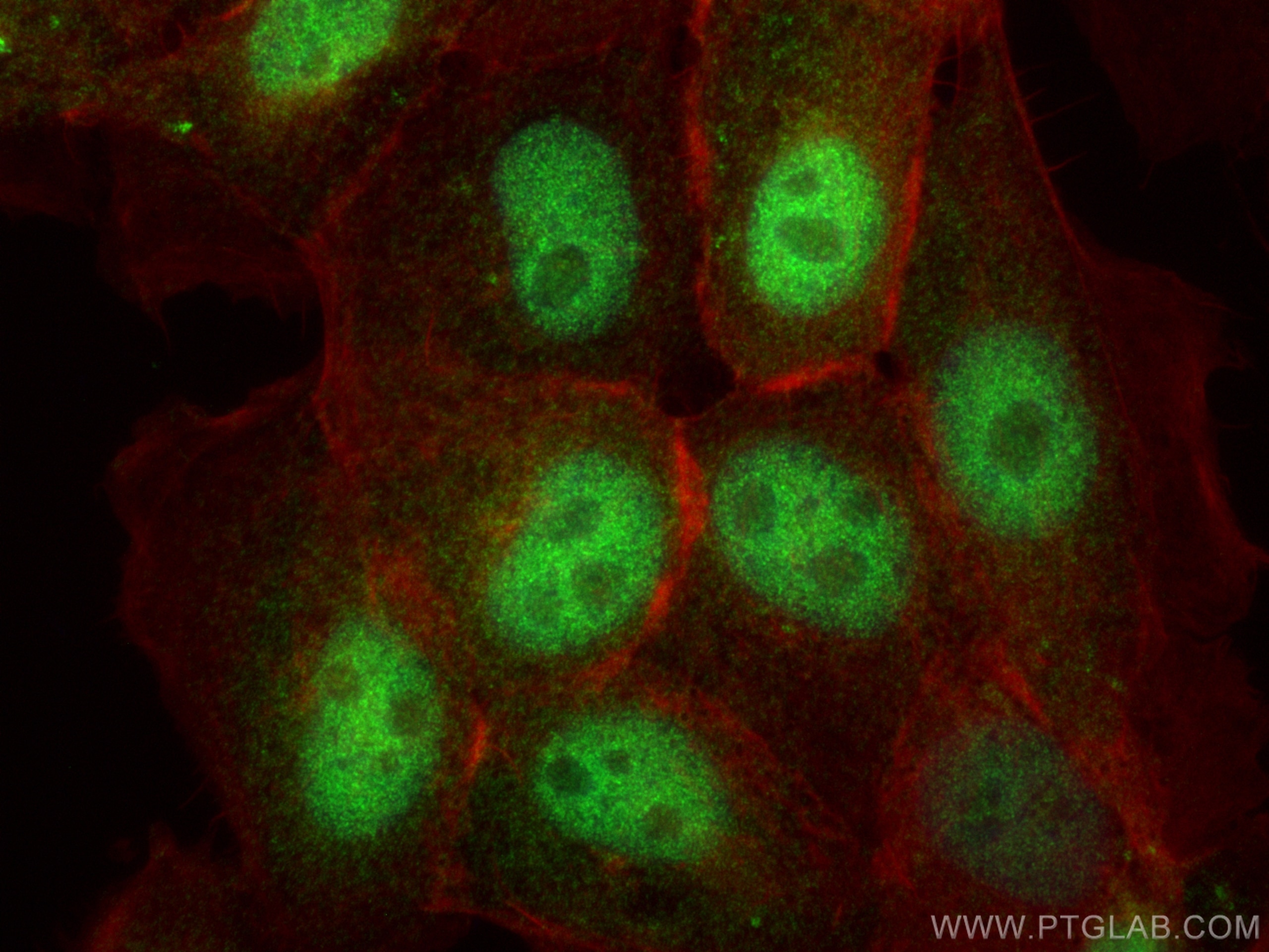 Immunofluorescence (IF) / fluorescent staining of U-251 cells using C16orf75 Polyclonal antibody (30529-1-AP)