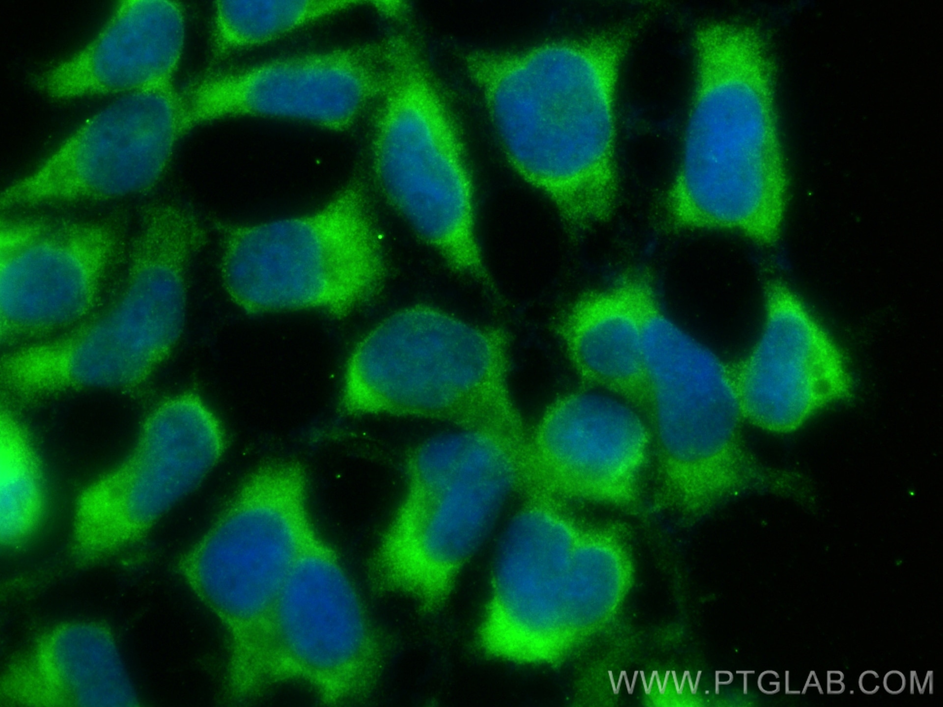 Immunofluorescence (IF) / fluorescent staining of HEK-293 cells using C16orf84 Polyclonal antibody (23337-1-AP)
