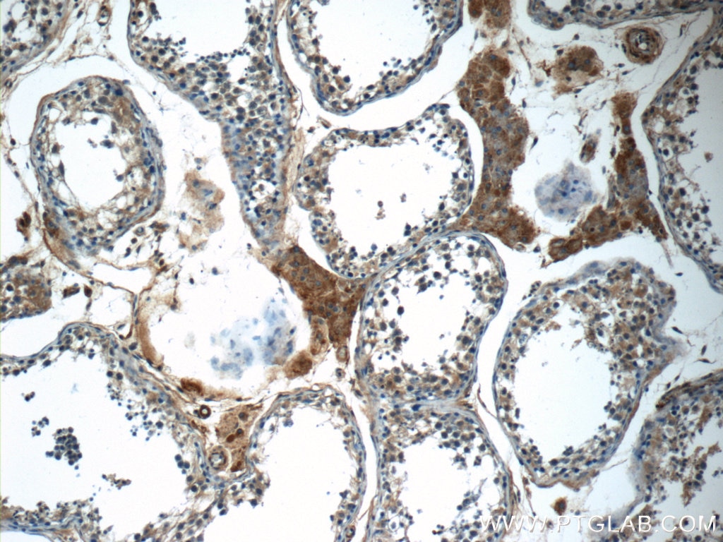 Immunohistochemistry (IHC) staining of human testis tissue using C16orf84 Polyclonal antibody (23337-1-AP)