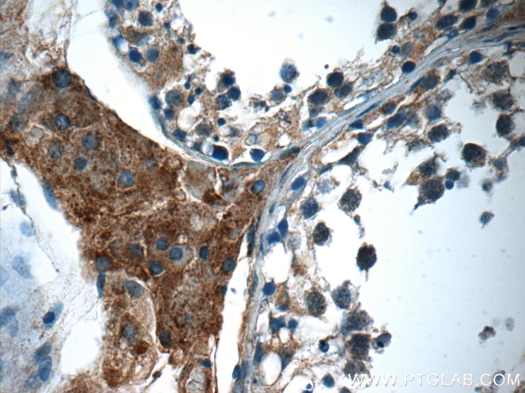 Immunohistochemistry (IHC) staining of human testis tissue using C16orf84 Polyclonal antibody (23337-1-AP)
