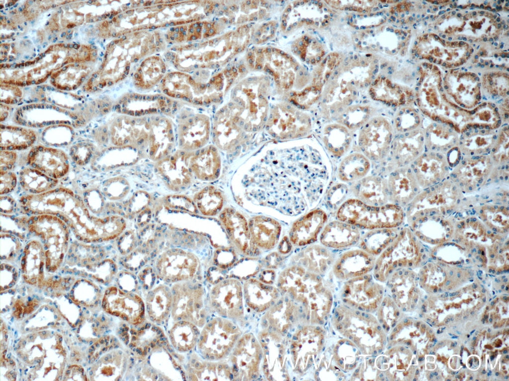 Immunohistochemistry (IHC) staining of human kidney tissue using C16orf84 Polyclonal antibody (23337-1-AP)