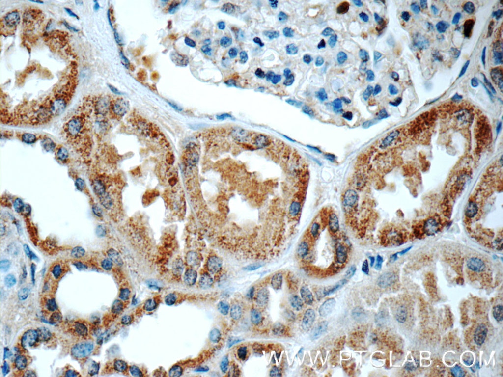 Immunohistochemistry (IHC) staining of human kidney tissue using C16orf84 Polyclonal antibody (23337-1-AP)