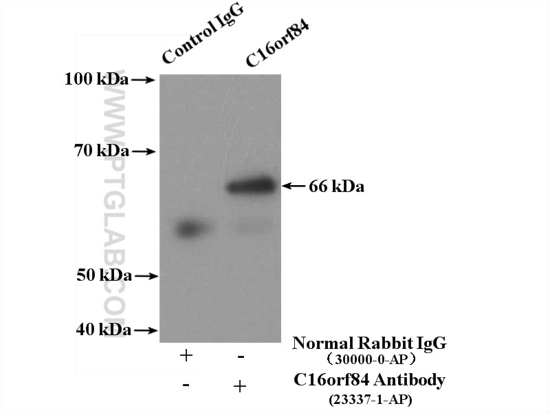 Immunoprecipitation (IP) experiment of HepG2 cells using C16orf84 Polyclonal antibody (23337-1-AP)