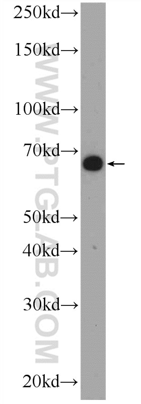 Western Blot (WB) analysis of HepG2 cells using C16orf84 Polyclonal antibody (23337-1-AP)