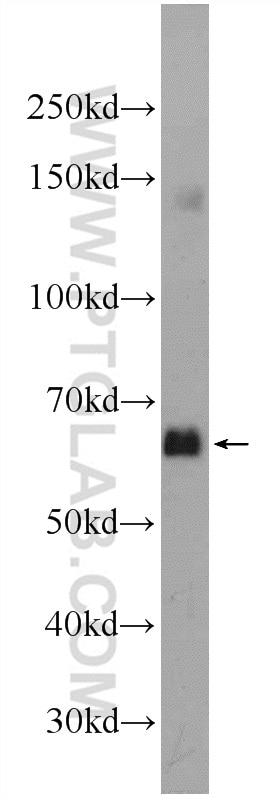 Western Blot (WB) analysis of mouse liver tissue using C16orf84 Polyclonal antibody (23337-1-AP)