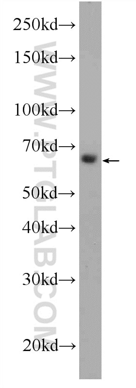 Western Blot (WB) analysis of Raji cells using C16orf84 Polyclonal antibody (23337-1-AP)