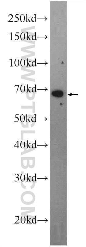 Western Blot (WB) analysis of mouse spleen tissue using C16orf84 Polyclonal antibody (23337-1-AP)