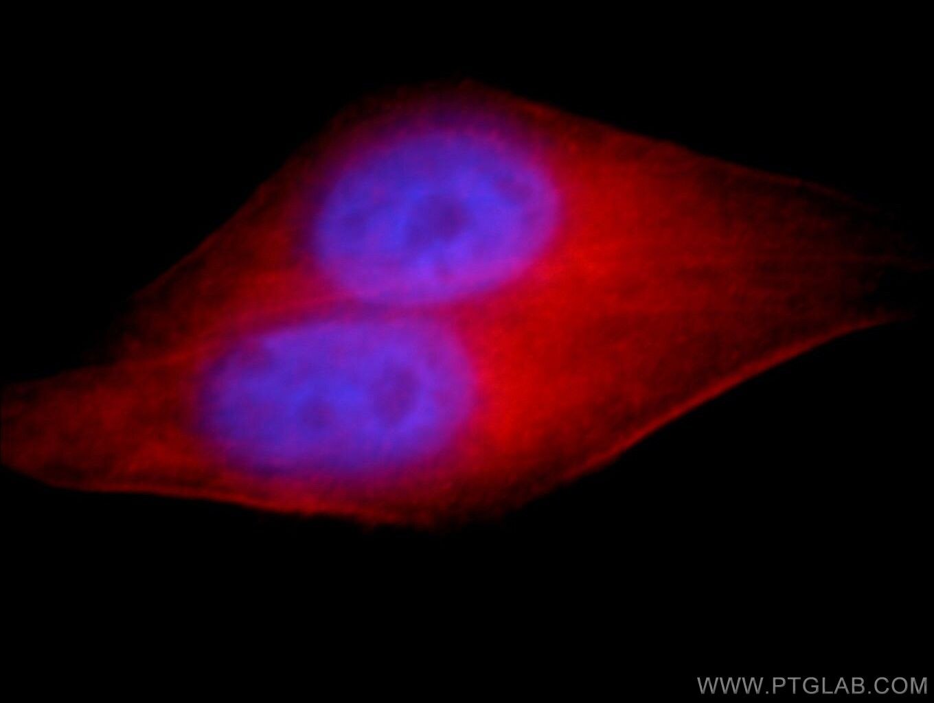 Immunofluorescence (IF) / fluorescent staining of HeLa cells using C17orf28 Polyclonal antibody (21174-1-AP)