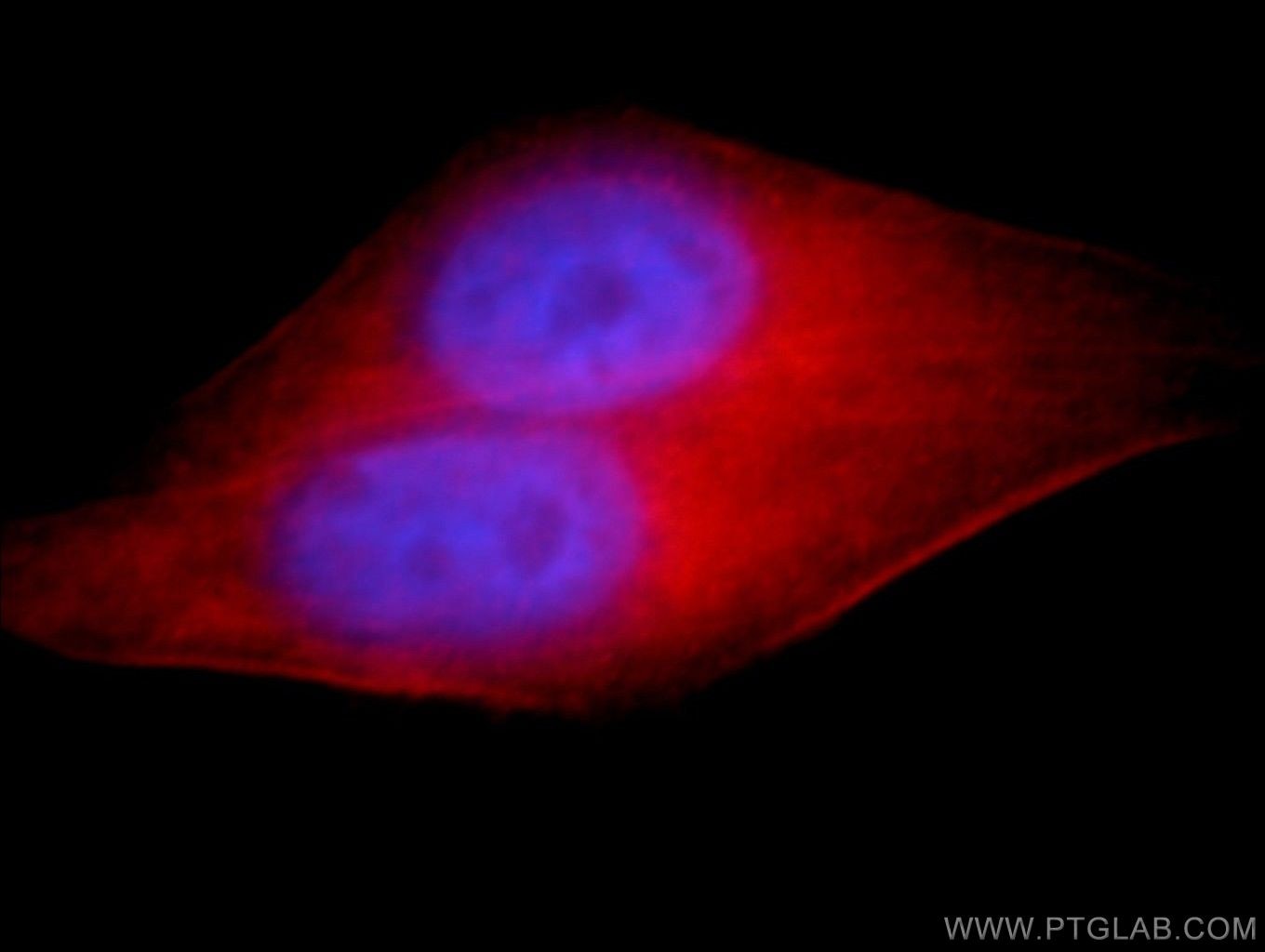 IF Staining of HeLa using 21174-1-AP