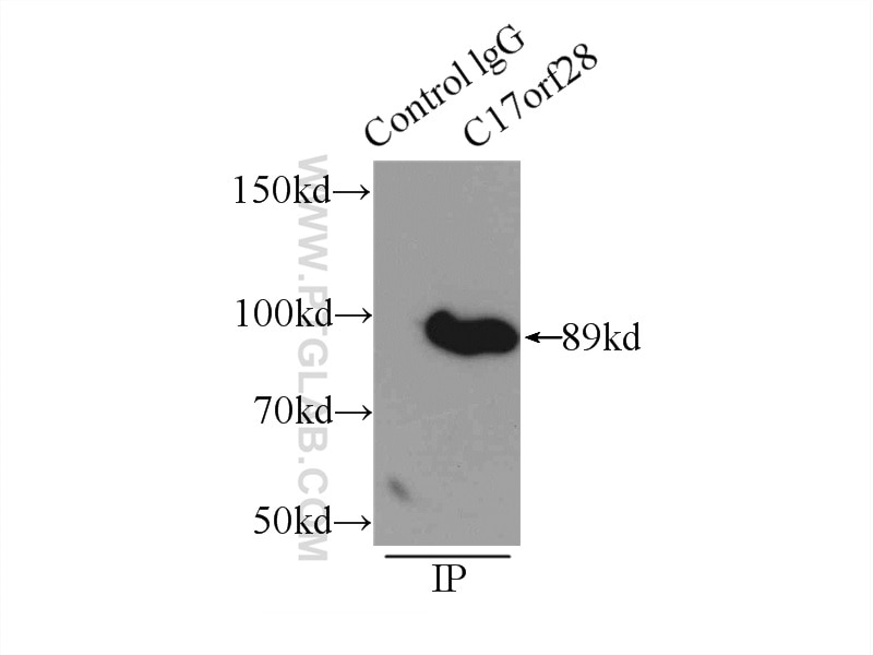 Immunoprecipitation (IP) experiment of mouse brain tissue using C17orf28 Polyclonal antibody (21174-1-AP)