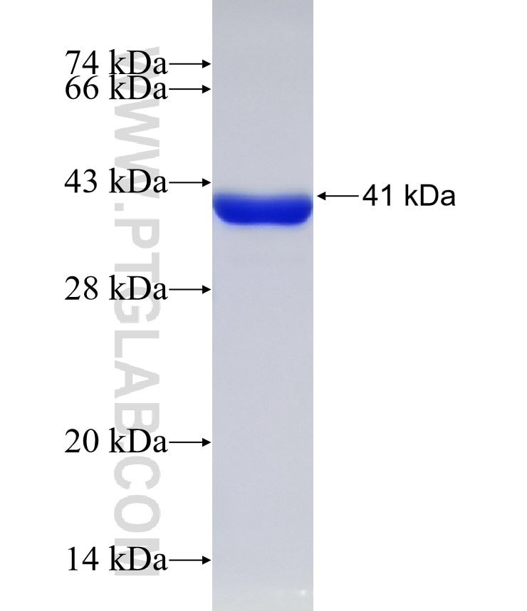 C17orf37 fusion protein Ag14975 SDS-PAGE