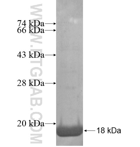 C17orf37 fusion protein Ag15084 SDS-PAGE