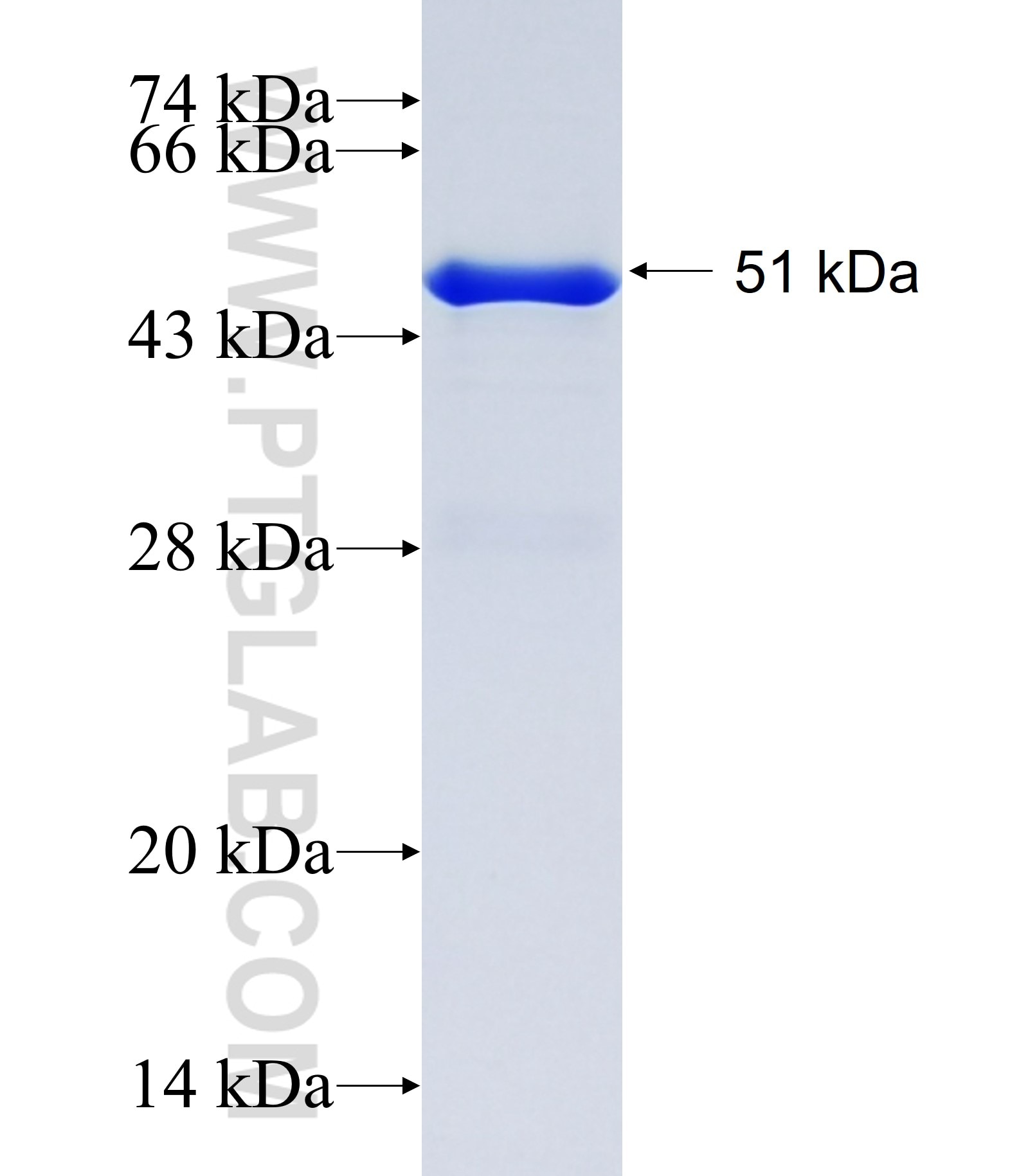 C17orf39 fusion protein Ag13925 SDS-PAGE