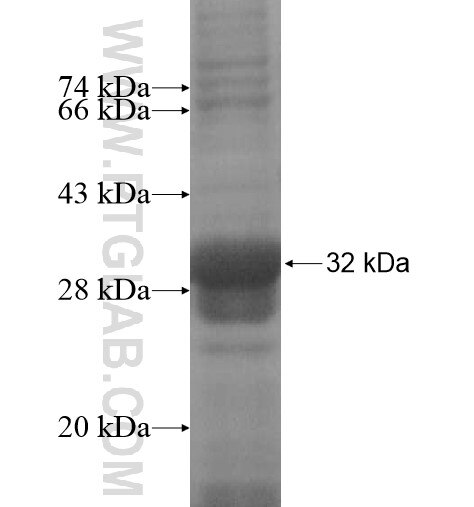 C17orf39 fusion protein Ag13973 SDS-PAGE