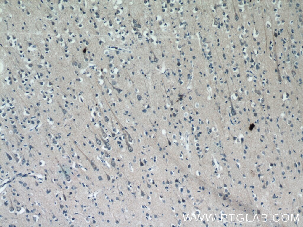 Immunohistochemistry (IHC) staining of human brain tissue using C17orf46 Polyclonal antibody (24629-1-AP)