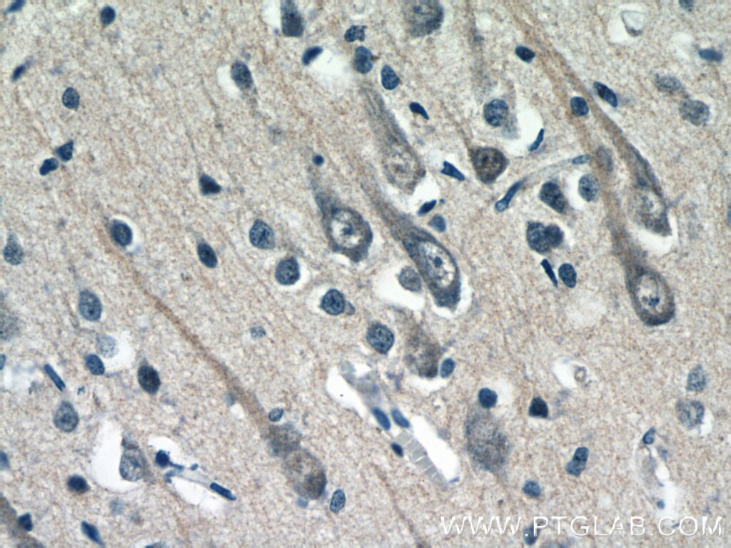 Immunohistochemistry (IHC) staining of human brain tissue using C17orf46 Polyclonal antibody (24629-1-AP)