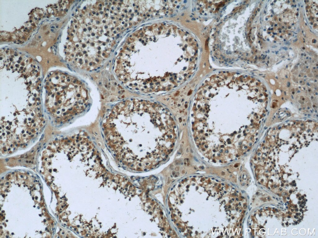 Immunohistochemistry (IHC) staining of human testis tissue using C17orf46 Polyclonal antibody (24629-1-AP)