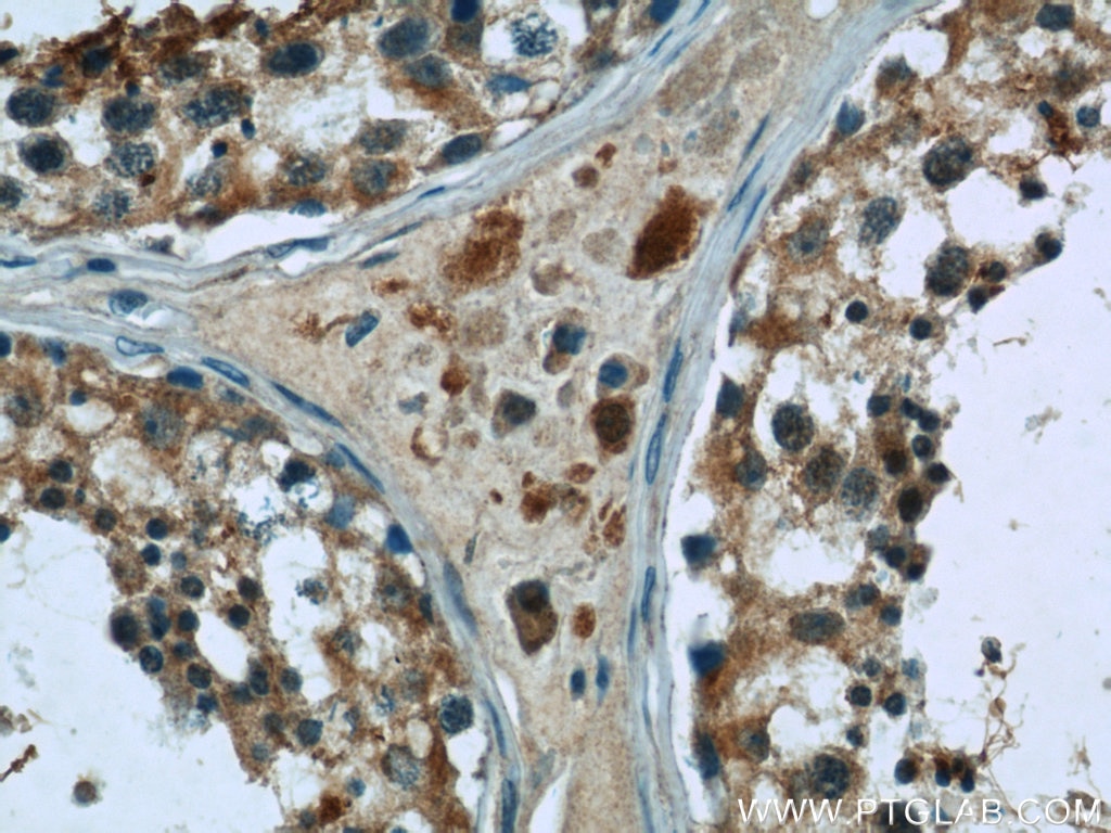 Immunohistochemistry (IHC) staining of human testis tissue using C17orf46 Polyclonal antibody (24629-1-AP)