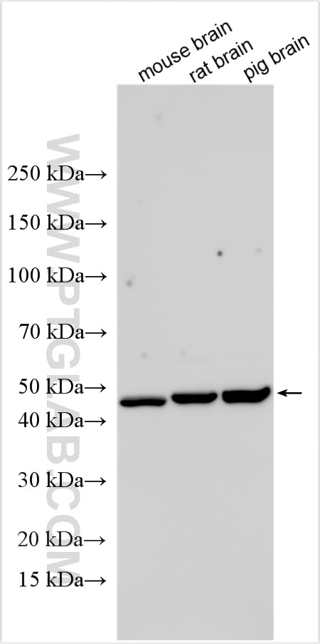 Western Blot (WB) analysis of various lysates using ADPRM Polyclonal antibody (17017-1-AP)