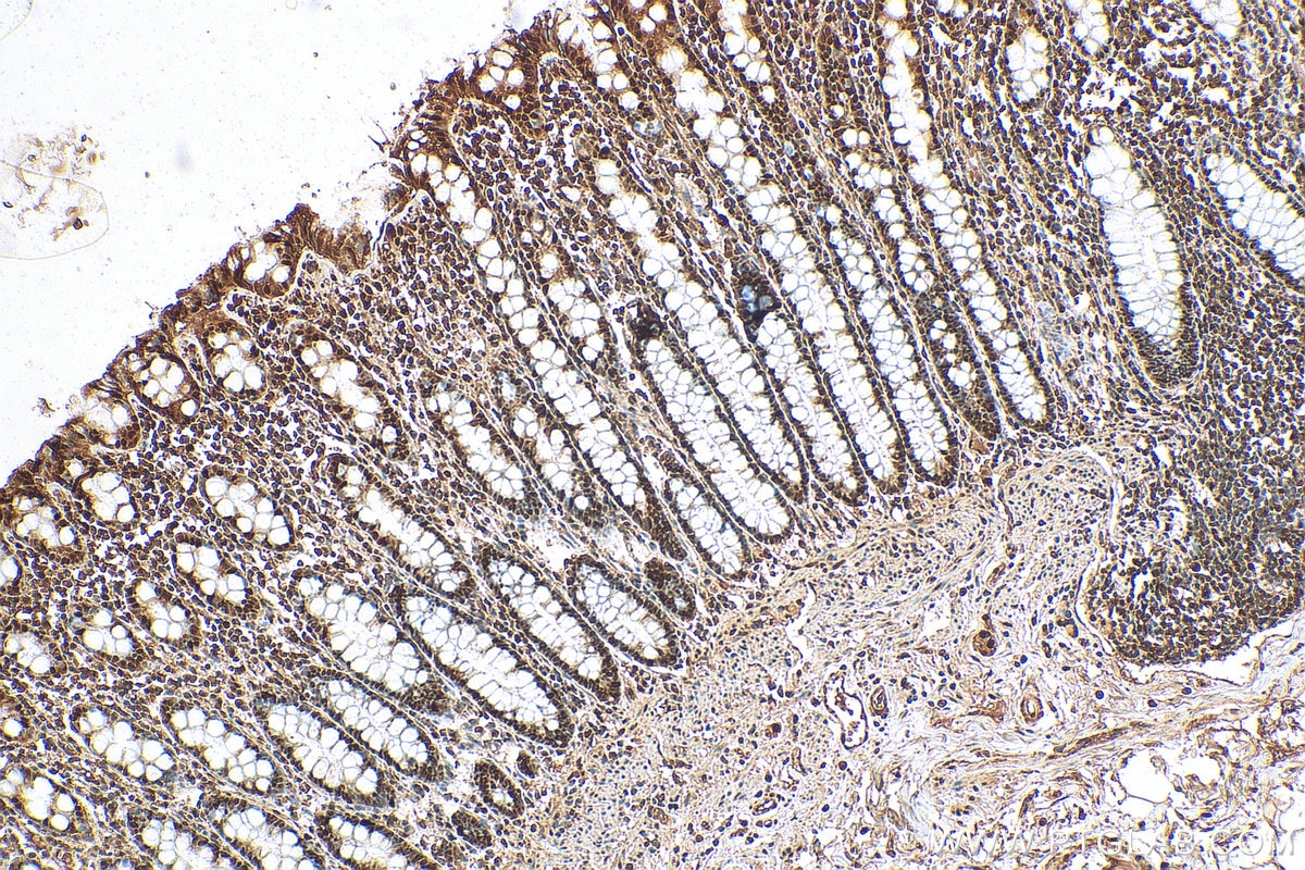 Immunohistochemistry (IHC) staining of human colon tissue using C17orf49 Polyclonal antibody (27114-1-AP)