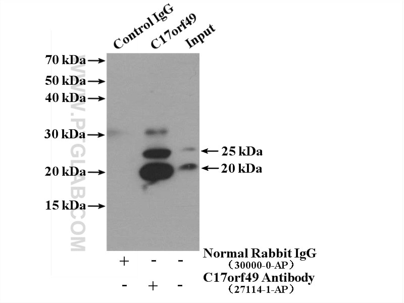 Immunoprecipitation (IP) experiment of PC-3 cells using C17orf49 Polyclonal antibody (27114-1-AP)