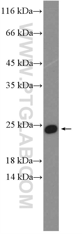 Western Blot (WB) analysis of Jurkat cells using C17orf49 Polyclonal antibody (27114-1-AP)