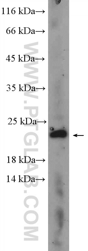 Western Blot (WB) analysis of mouse ovary tissue using C17orf49 Polyclonal antibody (27114-1-AP)