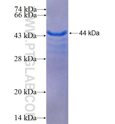 C17orf49 fusion protein Ag25882 SDS-PAGE
