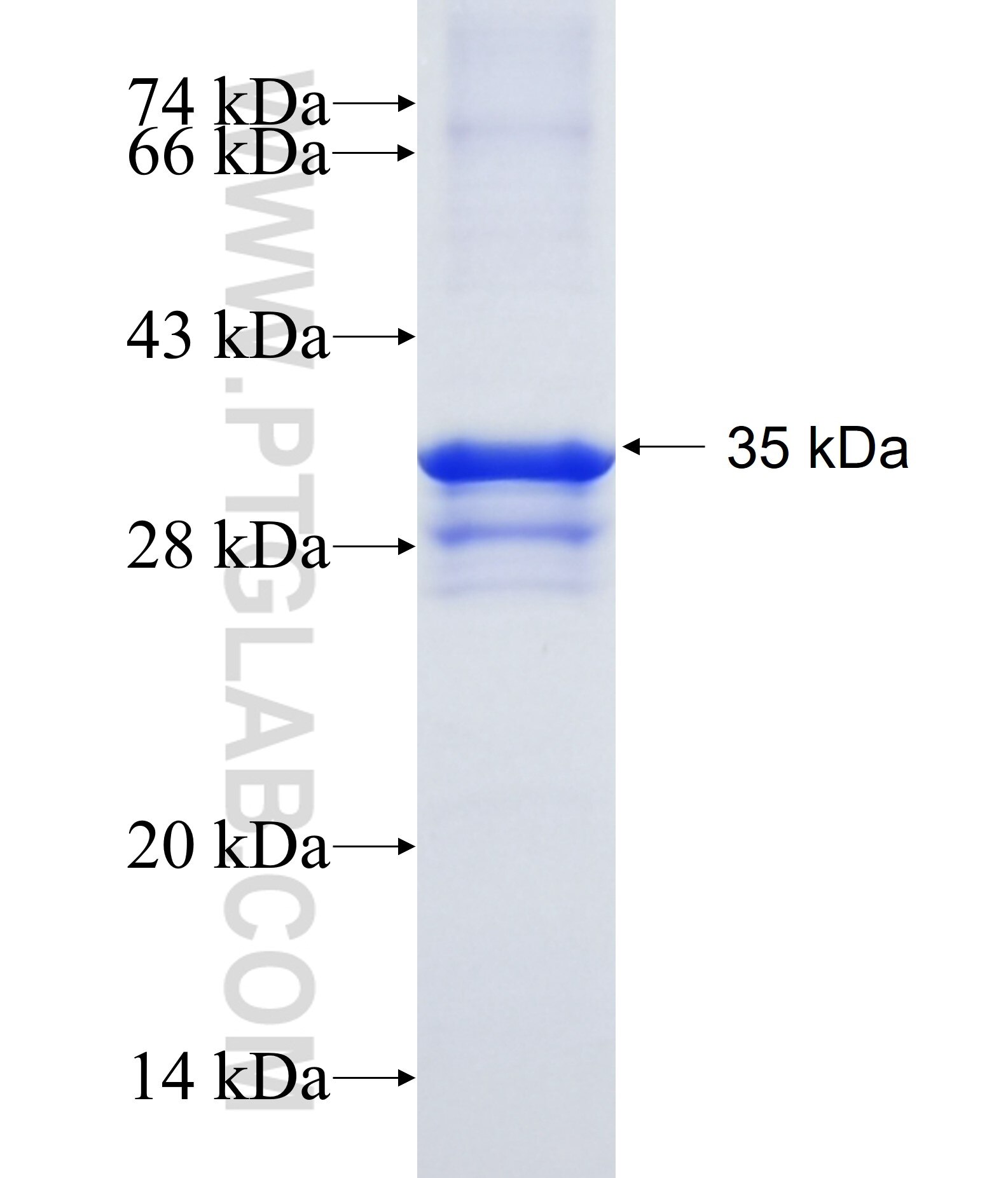 C17orf58 fusion protein Ag23344 SDS-PAGE