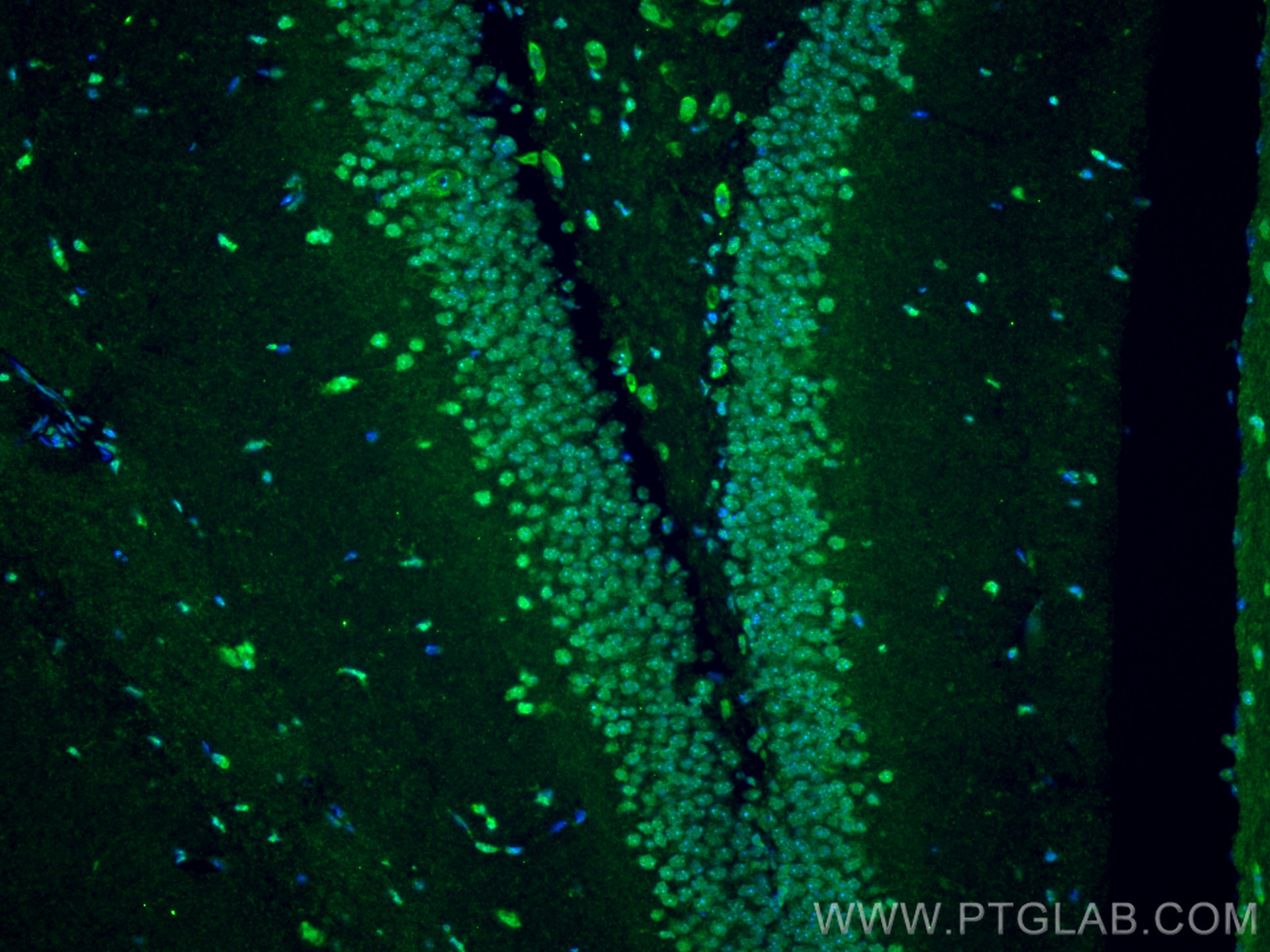 Immunofluorescence (IF) / fluorescent staining of mouse brain tissue using CTC1 Polyclonal antibody (28268-1-AP)