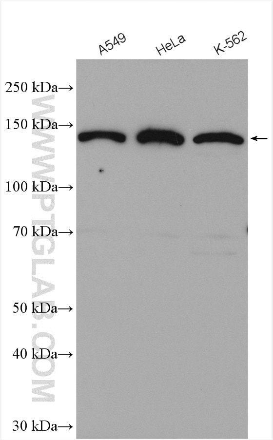 Western Blot (WB) analysis of various lysates using CTC1 Polyclonal antibody (28268-1-AP)