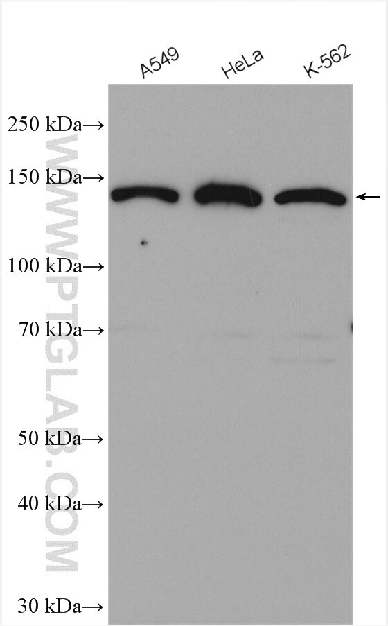 Western Blot (WB) analysis of various lysates using CTC1 Polyclonal antibody (28268-1-AP)