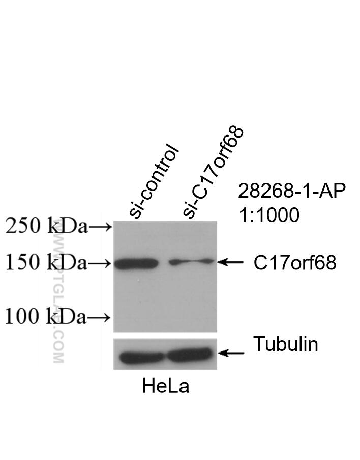 Western Blot (WB) analysis of HeLa cells using CTC1 Polyclonal antibody (28268-1-AP)